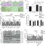 UCP1 Antibody in Western Blot (WB)