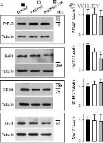 beta Tubulin Antibody in Western Blot (WB)