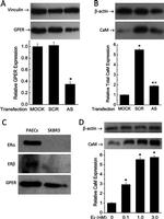 Estrogen Receptor alpha Antibody in Western Blot (WB)