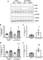 GSK3 alpha/beta Antibody in Western Blot (WB)