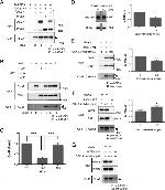 PICK1 Antibody in Western Blot, Immunoprecipitation (WB, IP)