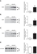 Phospho-Aquaporin 2 (Ser269) Antibody in Western Blot (WB)