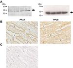 Phospho-Aquaporin 2 (Ser269) Antibody in Western Blot (WB)