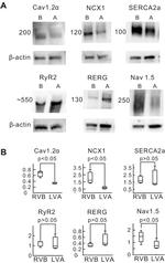 Sodium/Calcium Exchanger Antibody in Western Blot (WB)