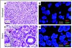 c-Met Antibody in Immunohistochemistry (IHC)