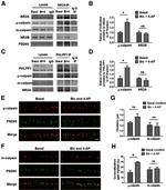 Mu-Calpain Antibody in Western Blot (WB)