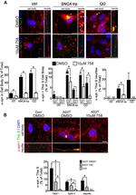 Synapsin 1 Antibody in Immunocytochemistry (ICC/IF)