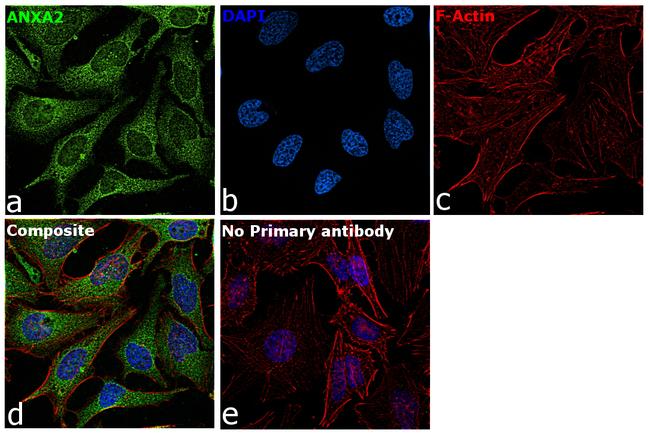 Annexin A2 Antibody in Immunocytochemistry (ICC/IF)