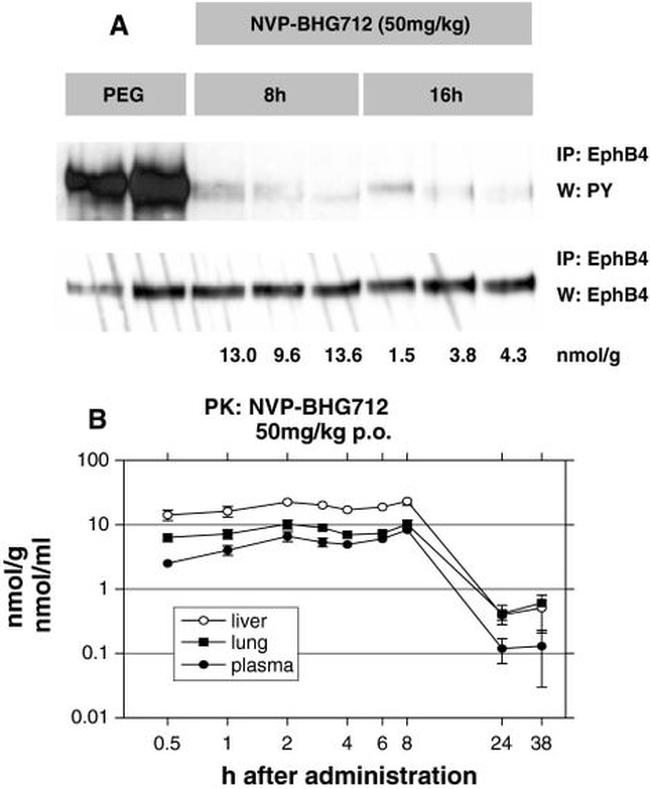 Phosphotyrosine Antibody in Western Blot (WB)