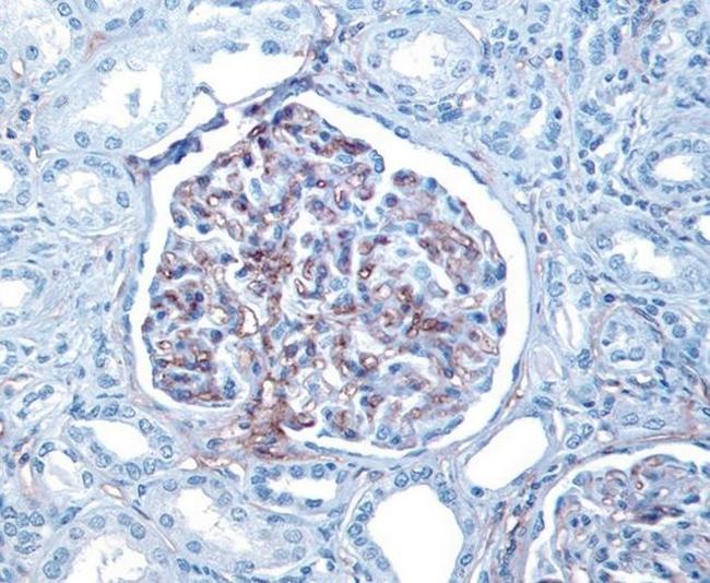 CD34 Antibody in Immunohistochemistry (IHC)