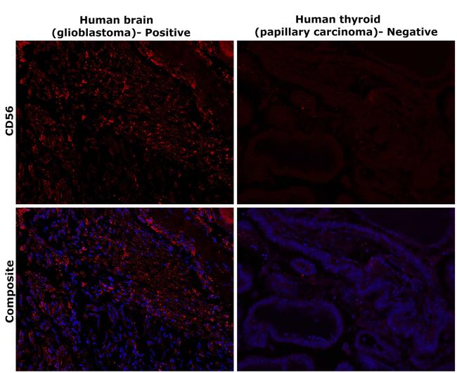 CD56 Antibody in Immunohistochemistry (Paraffin) (IHC (P))