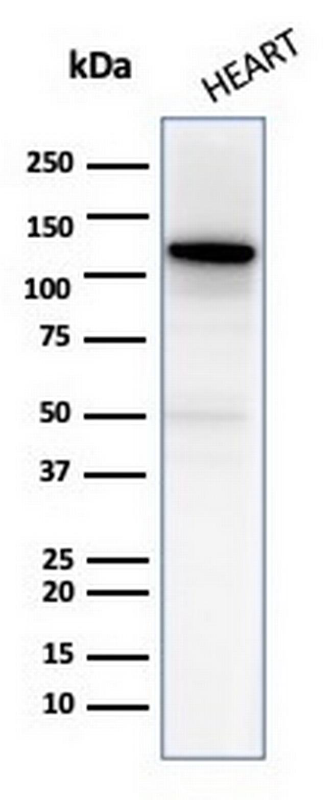 N-Cadherin/Cadherin-2/CD325 (NCAD) Antibody in Western Blot (WB)