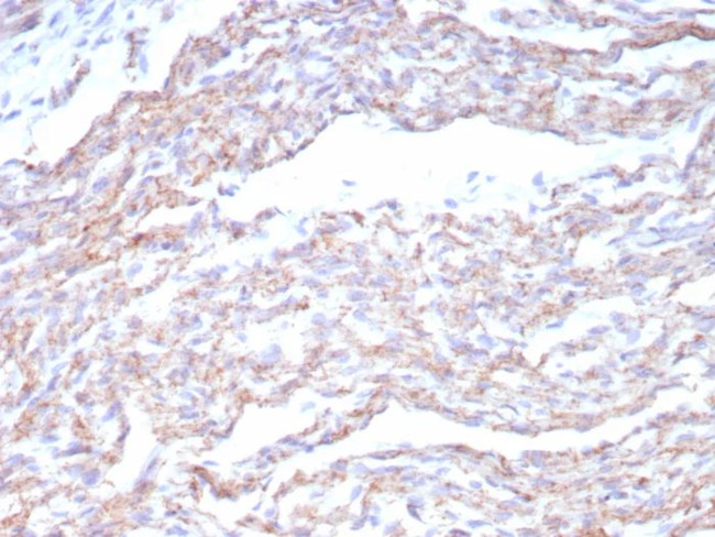 N-Cadherin/Cadherin-2/CD325 (NCAD) Antibody in Immunohistochemistry (Paraffin) (IHC (P))