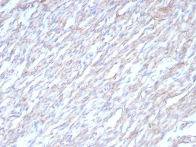 N-Cadherin/Cadherin-2/CD325 (NCAD) Antibody in Immunohistochemistry (Paraffin) (IHC (P))