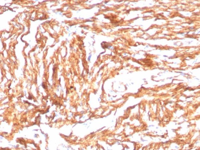 N-Cadherin/Cadherin-2/CD325 (NCAD) Antibody in Immunohistochemistry (Paraffin) (IHC (P))