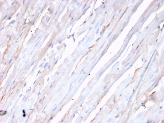 N-Cadherin/Cadherin-2/CD325 (NCAD) Antibody in Immunohistochemistry (Paraffin) (IHC (P))