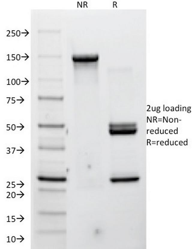 P-Cadherin (CDH3) Antibody in SDS-PAGE (SDS-PAGE)