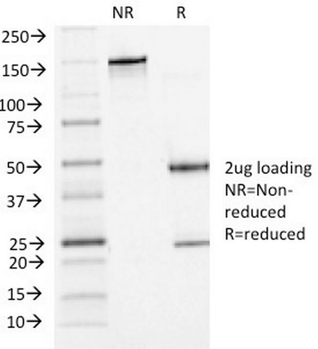 P-Cadherin (CDH3) Antibody in SDS-PAGE (SDS-PAGE)