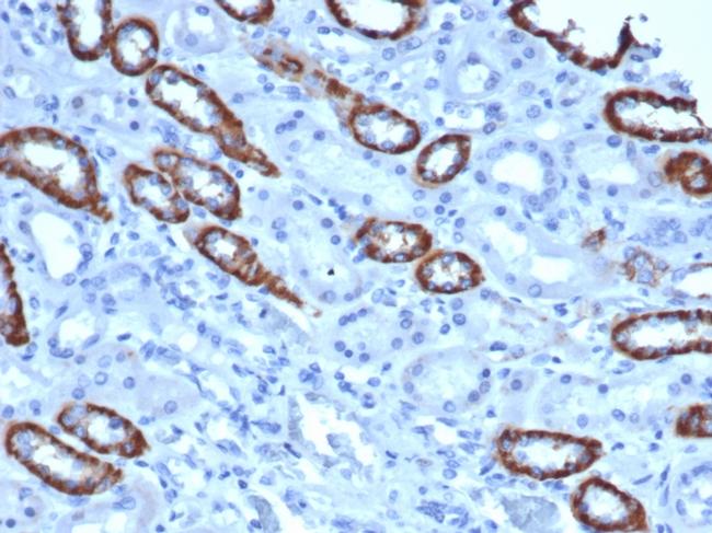 TOM1L1 (Target of Myb1 Like 1 Membrane Trafficking Protein) Antibody in Immunohistochemistry (Paraffin) (IHC (P))