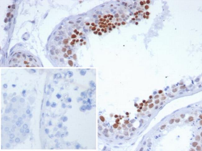 NUT1/NUTM1/Snurportin 1 Antibody in Immunohistochemistry (Paraffin) (IHC (P))