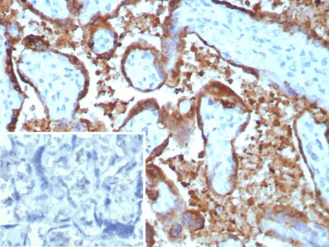 EBI3/Epstein-Barr virus induced 3 Antibody in Immunohistochemistry (Paraffin) (IHC (P))