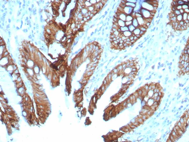 Cadherin 17/LI Cadherin (Liver-Intestine Marker) Antibody in Immunohistochemistry (Paraffin) (IHC (P))