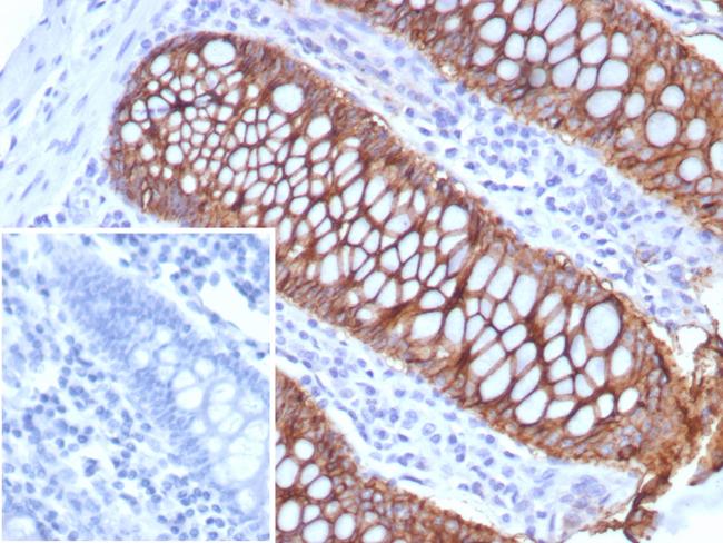 Cadherin 17/LI Cadherin (Liver-Intestine Marker) Antibody in Immunohistochemistry (Paraffin) (IHC (P))