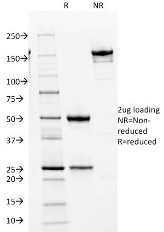 Cdk2/p34cdc2 Serine-Threonine Kinase Antibody in SDS-PAGE (SDS-PAGE)