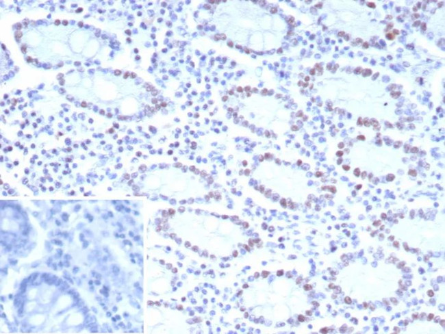 CDK4 Antibody in Immunohistochemistry (Paraffin) (IHC (P))