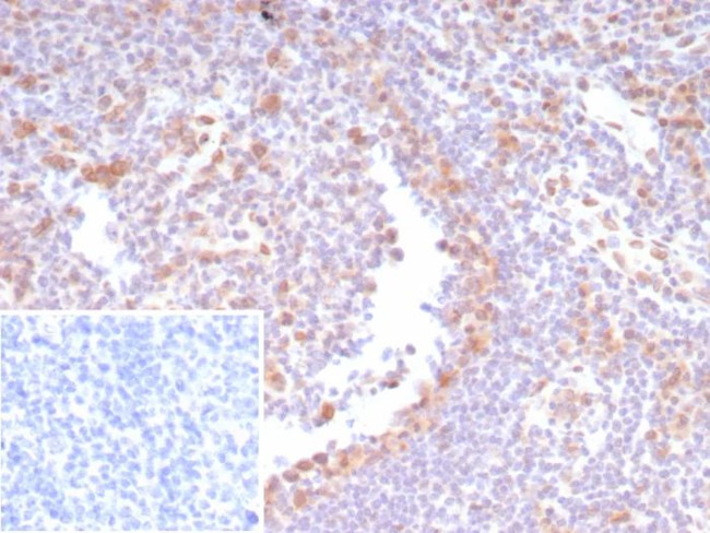 CDK4 Antibody in Immunohistochemistry (Paraffin) (IHC (P))