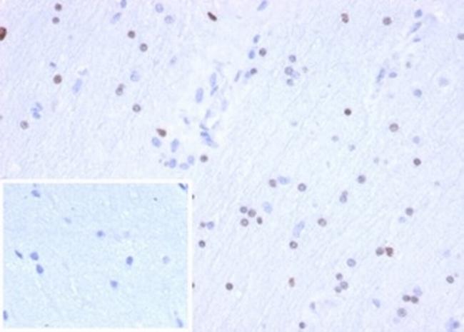 OLIG2 (Marker of Glial Brain Tumors) Antibody in Immunohistochemistry (Paraffin) (IHC (P))