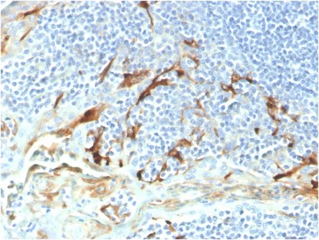 Mesothelin (Mesothelial Marker) Antibody in Immunohistochemistry (Paraffin) (IHC (P))