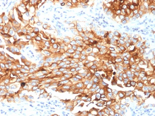 Mesothelin Antibody in Immunohistochemistry (Paraffin) (IHC (P))