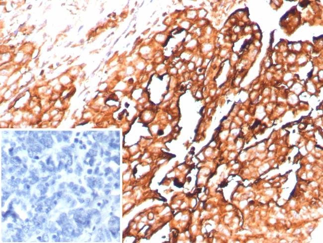 Mesothelin (Mesothelial Marker) Antibody in Immunohistochemistry (Paraffin) (IHC (P))