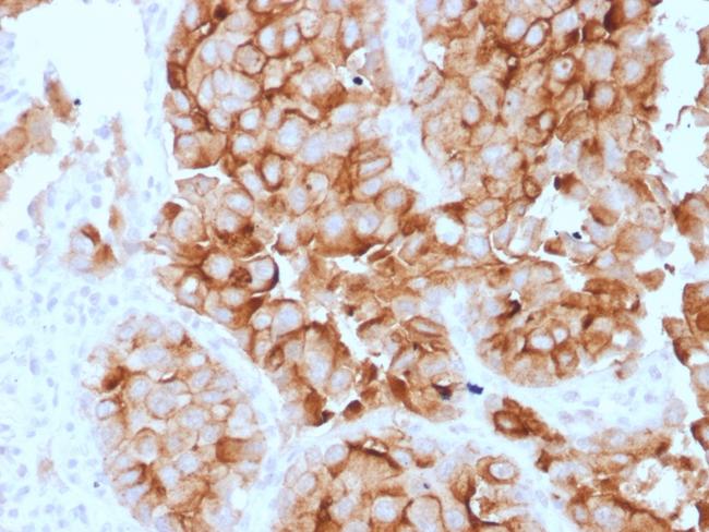 Mesothelin (Mesothelial Marker) Antibody in Immunohistochemistry (Paraffin) (IHC (P))