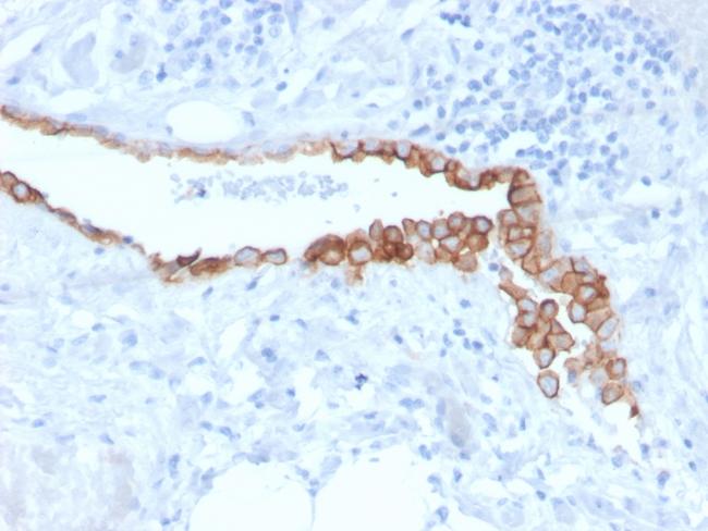 Mesothelin (Mesothelial Marker) Antibody in Immunohistochemistry (Paraffin) (IHC (P))