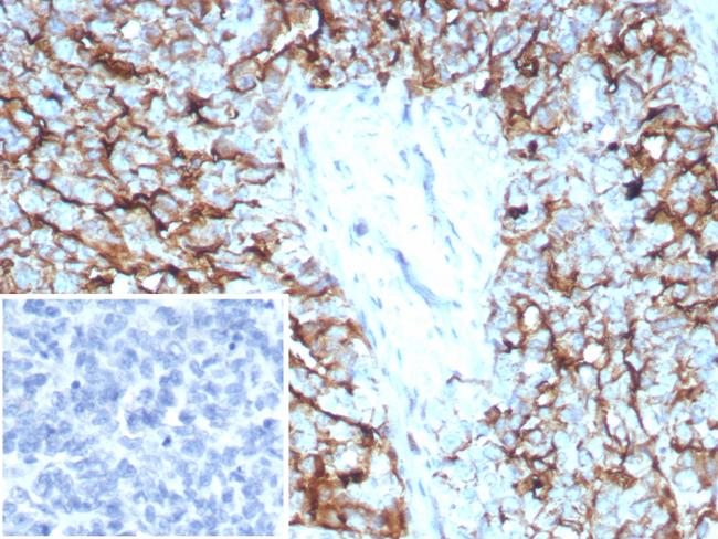 Mesothelin (Mesothelial Marker) Antibody in Immunohistochemistry (Paraffin) (IHC (P))