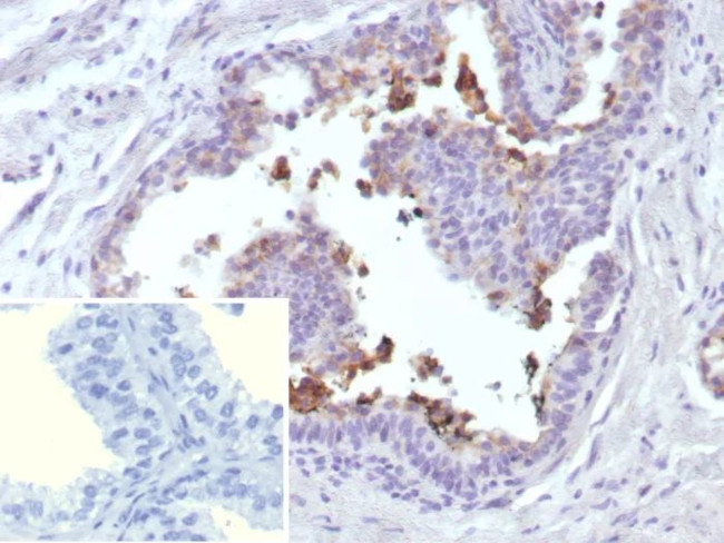 ABCC4/ATP Binding Cassette Subfamily C Member 4 (Drug Target) Antibody in Immunohistochemistry (Paraffin) (IHC (P))