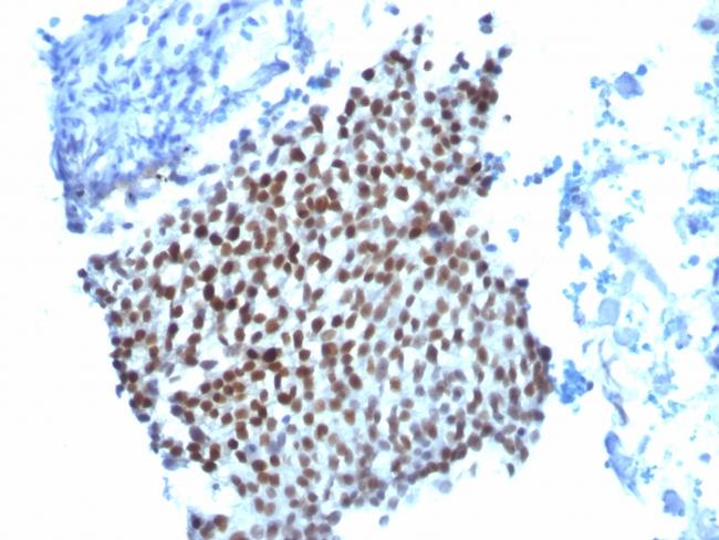 p21WAF1 (Tumor Suppressor Protein) Antibody in Immunohistochemistry (Paraffin) (IHC (P))