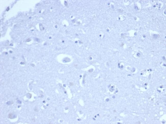 p21WAF1 (Tumor Suppressor Protein) Antibody in Immunohistochemistry (Paraffin) (IHC (P))