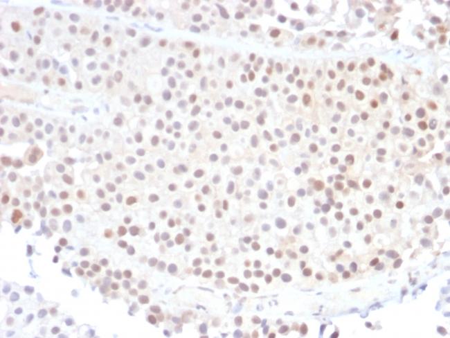 p21WAF1 (Tumor Suppressor Protein) Antibody in Immunohistochemistry (Paraffin) (IHC (P))