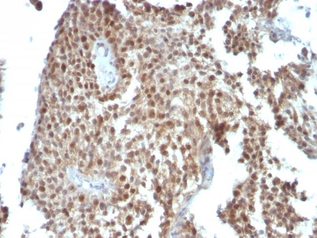 p21WAF1 (Tumor Suppressor Protein) Antibody in Immunohistochemistry (Paraffin) (IHC (P))