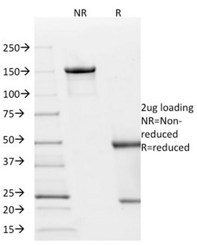 p21WAF1 (Tumor Suppressor Protein) Antibody in SDS-PAGE (SDS-PAGE)