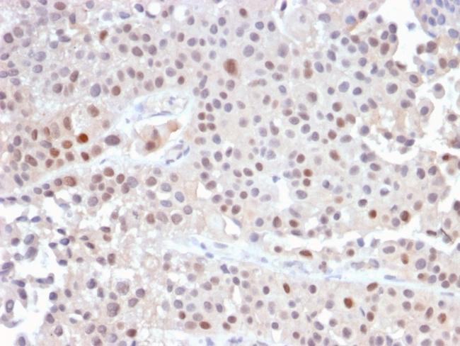 p21WAF1 (Tumor Suppressor Protein) Antibody in Immunohistochemistry (Paraffin) (IHC (P))