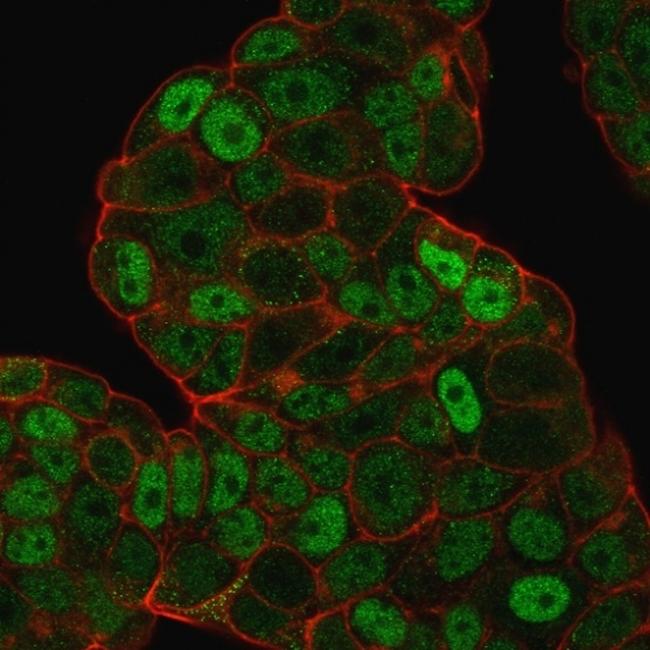 p27Kip1 (Mitotic Inhibitor/Suppressor Protein) Antibody in Immunocytochemistry (ICC/IF)