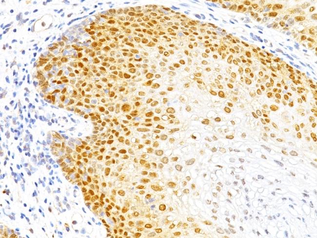 p27Kip1 (Mitotic Inhibitor/Suppressor Protein) Antibody in Immunohistochemistry (Paraffin) (IHC (P))