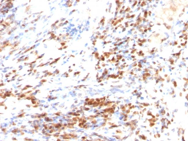 p27Kip1 (Mitotic Inhibitor/Suppressor Protein) Antibody in Immunohistochemistry (Paraffin) (IHC (P))