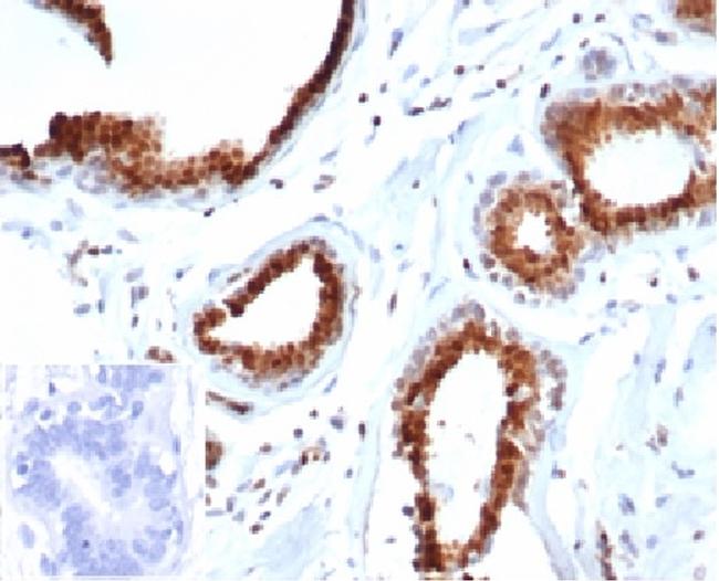 p27Kip1 (Mitotic Inhibitor/Suppressor Protein) Antibody in Immunohistochemistry (Paraffin) (IHC (P))