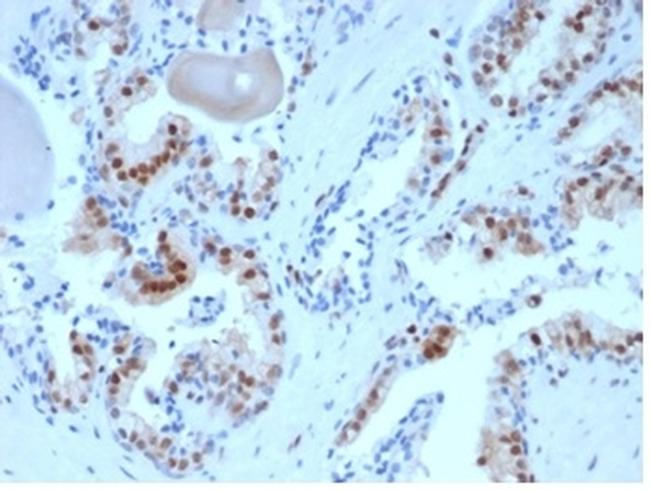 p27Kip1 (Mitotic Inhibitor/Suppressor Protein) Antibody in Immunohistochemistry (Paraffin) (IHC (P))