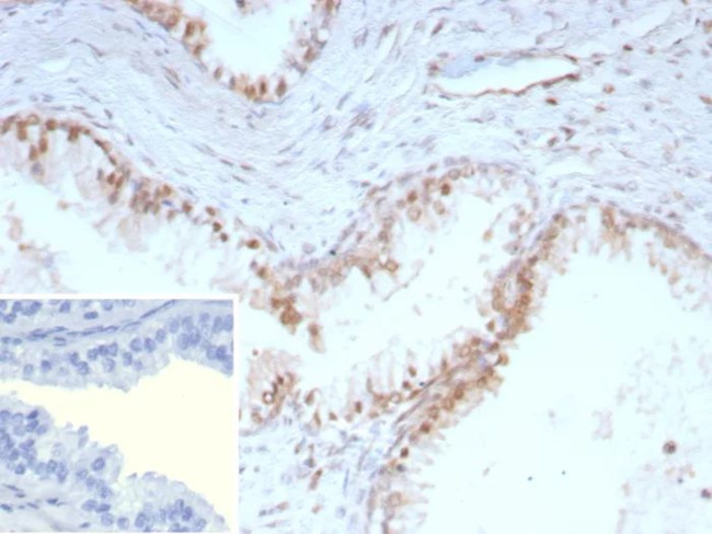 p27Kip1 (Mitotic Inhibitor/Suppressor Protein) Antibody in Immunohistochemistry (Paraffin) (IHC (P))